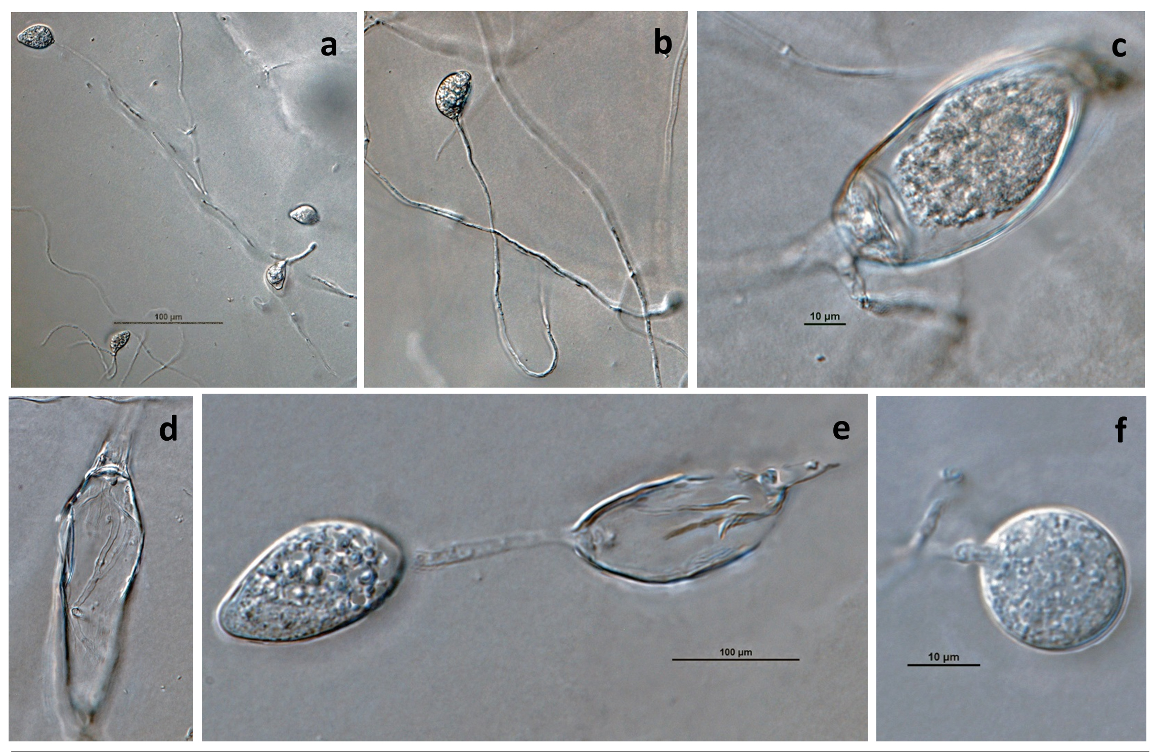   Phytophthora brassicae nbsp;ex-type CPHST BL 8, asexual phase (a-f): (a, b) sporangia produced in sporangiophores, (c) sporangium showing internal plug, (d) sporangium with internal proliferation, (e) sporangium with external proliferation, (f) globose sporangium; photos by G. Abad, USDA-APHIS-PPQ. 
